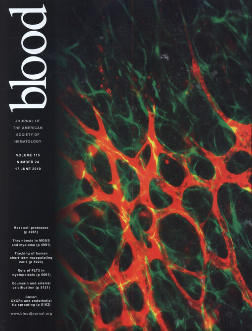 Blood : journal of hematology