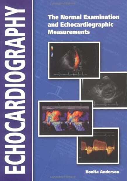 Echocardiography : the normal examination and echocardiographic measurements
