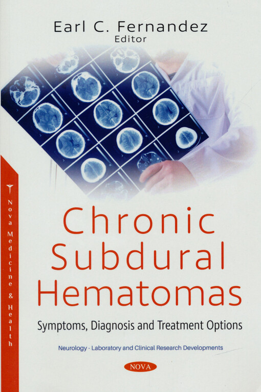 Chronic subdural hematomas : symptoms, diagnosis and treatment options