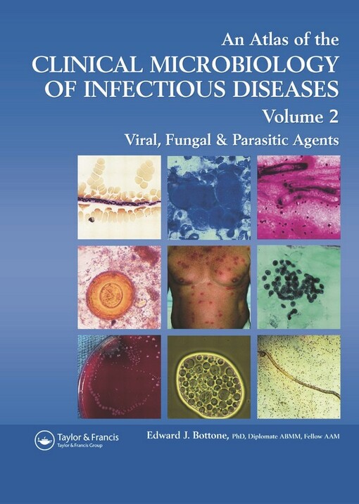 Atlas of the Clinical Microbiology of Infectious Diseases, Volume 2: Viral, Fungal, and Parasitic Agents (Encyclopedia of Visual Medicine Series)