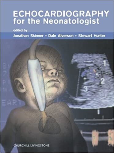 Echocardiography for the neonatologist