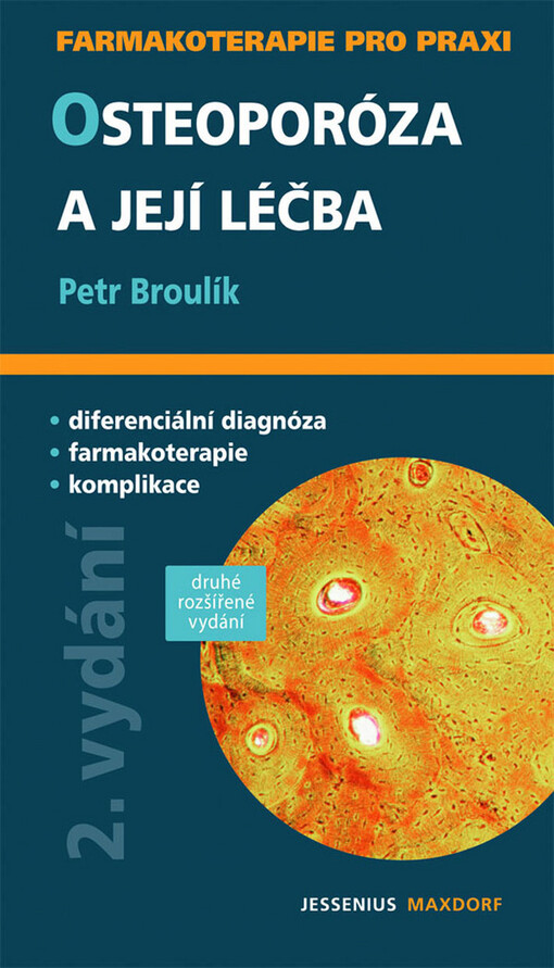 Osteoporóza a její léčba : průvodce ošetřujícího lékaře