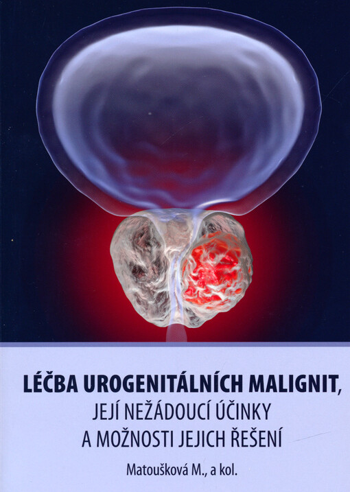 Léčba urogenitálních malignit, její nežádoucí účinky a možnosti jejich řešení