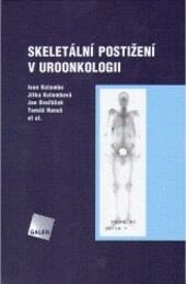 Skeletální postižení v uroonkologii
