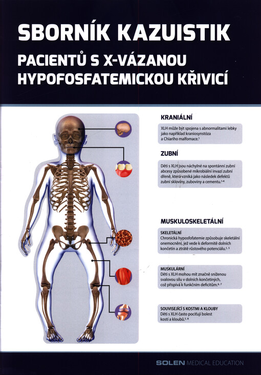 Sborník kazuistik pacientů s x-vázanou hypofosfatemickou křivicí