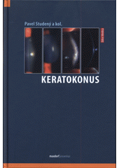 Keratokonus  (odkaz v elektronickém katalogu)