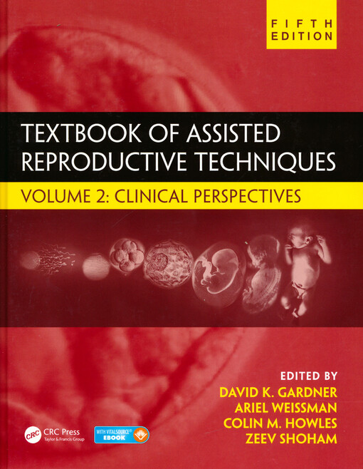 Textbook of assisted reproductive techniques. Volume 2, Clinical perspectives