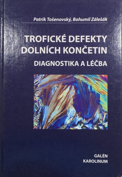 Trofické defekty dolních končetin : diagnostika a léčba