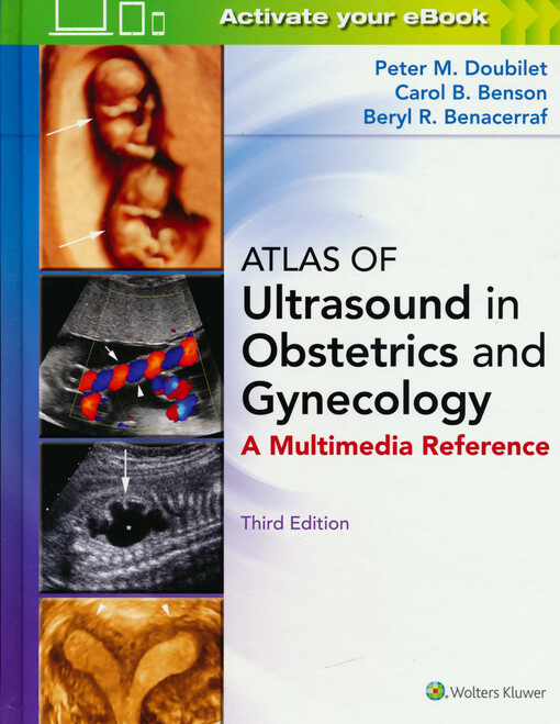 Atlas of ultrasound in obstetrics and gynecology : a multimedia reference