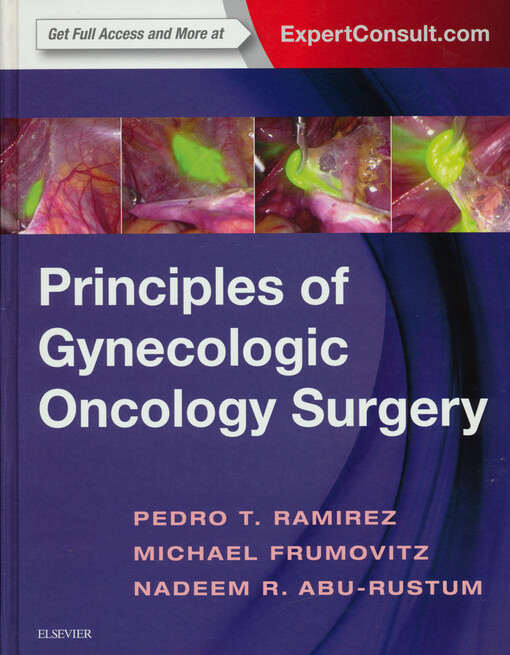 Principles of gynecologic oncology surgery