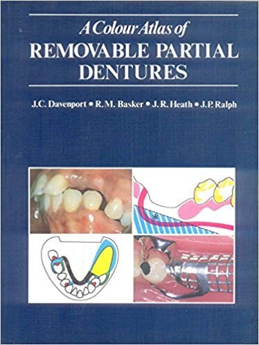 Color atlas of removable partial dentures