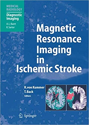 Magnetic Resonance Imaging in Ischemic Stroke (Medical Radiology / Diagnostic Imaging)