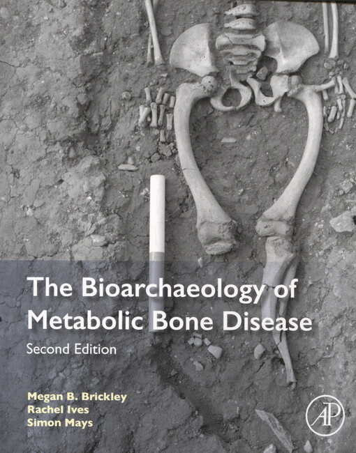 The bioarchaeology of metabolic bone disease