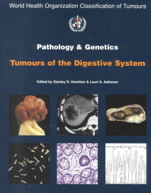 Pathology and Genetics of Tumours of the Digestive System