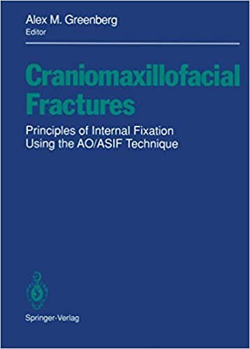 Craniomaxillofacial fractures : Principles of internal fixation using the AO/ASIF technique