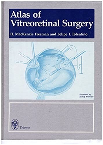 Atlas of Vitreoretinal Surgery