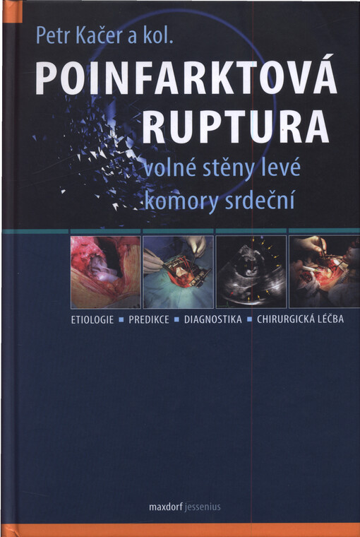 Poinfarktová ruptura volné stěny levé komory srdeční