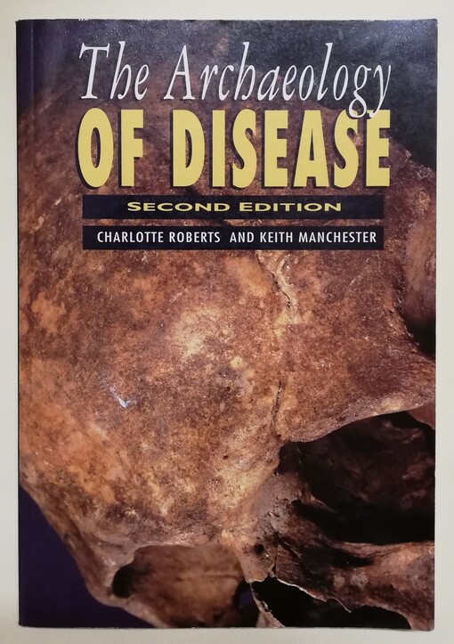 The archaeology of disease