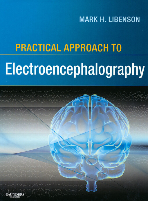 Practical approach to electroencephalography