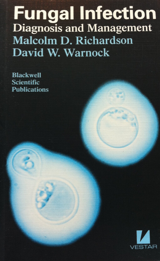 Fungal Infection: Diagnosis and Management (Pocket Consultant)