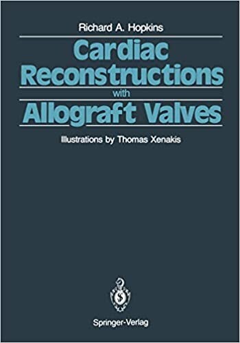Cardiac Reconstructions with Allograft Valves