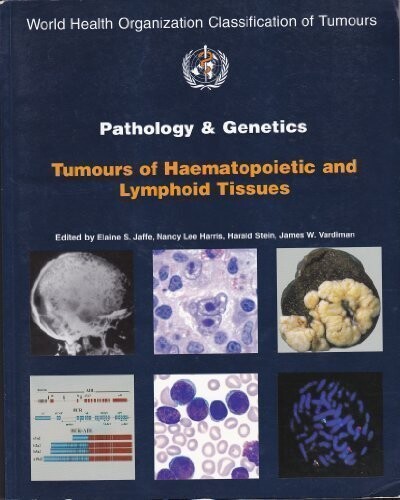 Pathology and Genetics: Tumours of Haematopoietic and Lymphoid Tissues (World Health Organization Classification of Tumours)