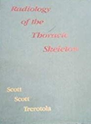 Radiology of the thoracic skeleton