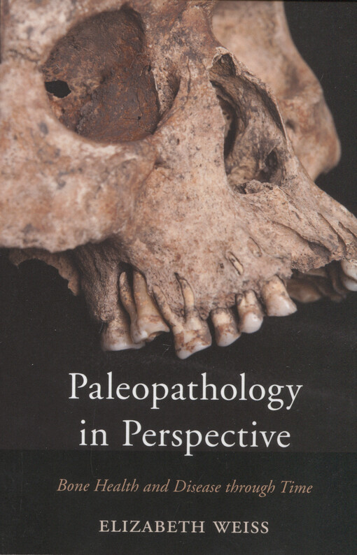 Paleopathology in perspective : bone health and disease through time