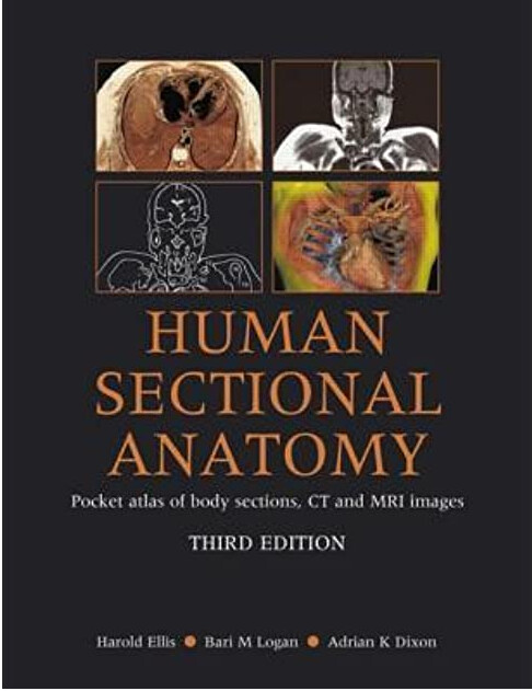 Human sectional anatomy : pocket atlas of body sections, CT and MRI images