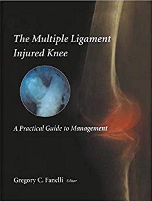 The Multiple Ligament Injured Knee: A Practical Guide to Management