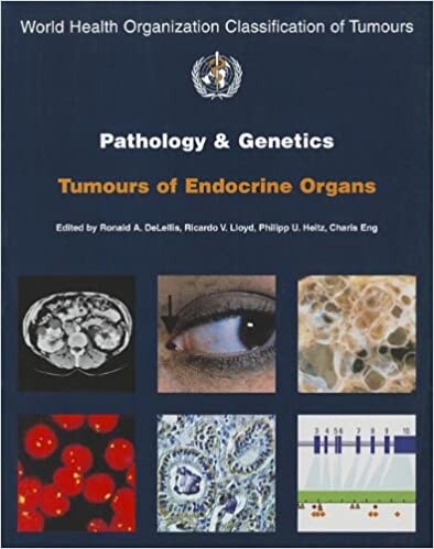 Pathology and Genetics of Tumours of Endocrine Organs (IARC WHO Classification of Tumours)
