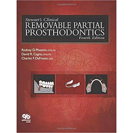 Stewart's Clinical Removable Partial Prosthodontics (Phoenix, Stewart's Clinical Removable Partial Prosthodontics)