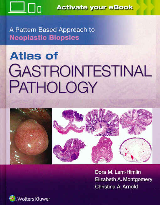Atlas of gastrointestinal pathology : a pattern based approach to neoplastic biopsies