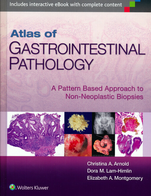 Atlas of gastrointestinal pathology : a pattern based approach to non-neoplastic biopsies