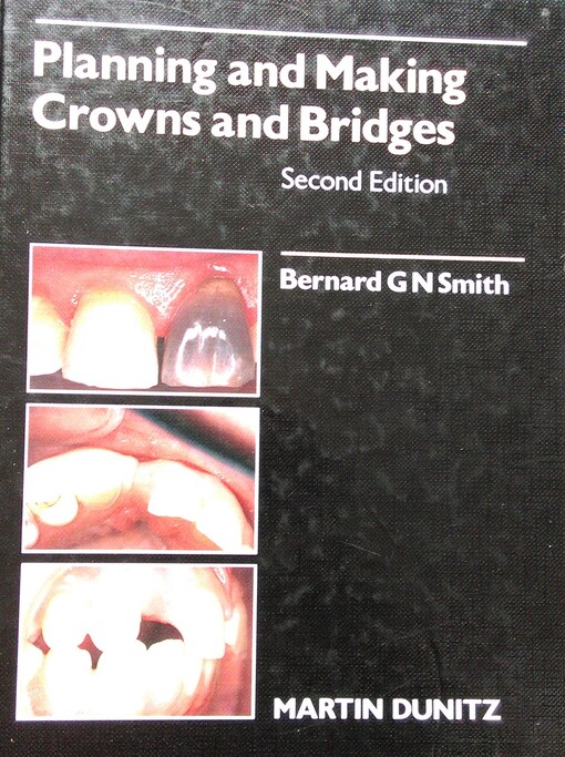 Planning & Making Crowns & Bri