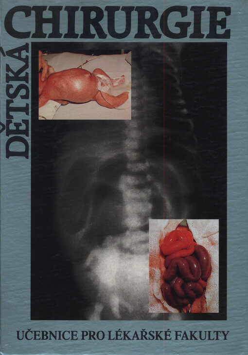 Dětská chirurgie : Učebnice pro lékařské fakulty