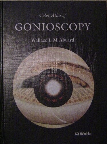 Color atlas of gonioscopy