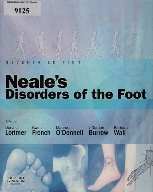 Neale's disorders of the foot