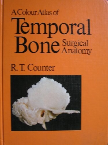 The colour atlas of temporal bone surgical antomy