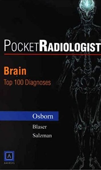 Brain : top 100 diagnoses