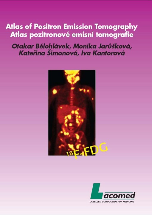 Pozitronová emisní tomografie s fluorodeoxyglukózou (FDG PET): atlas příkladů klinického využití = Positron emission tomography with fluorodeoxyglucose (FDG PET)