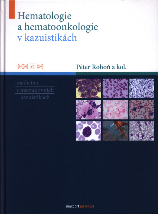 Hematologie a hematoonkologie v kazuistikách