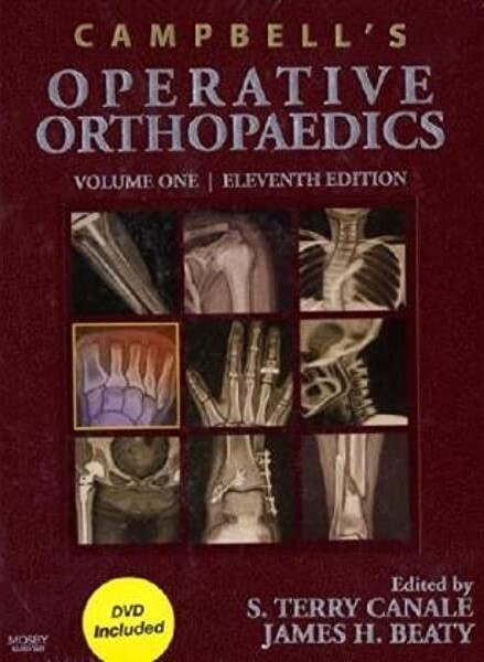 Campbell's operative orthopaedics