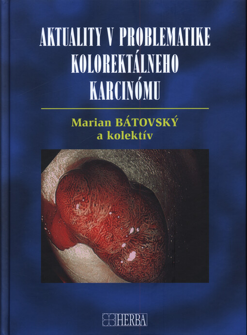 Aktuality v problematike kolorektálneho karcinómu
