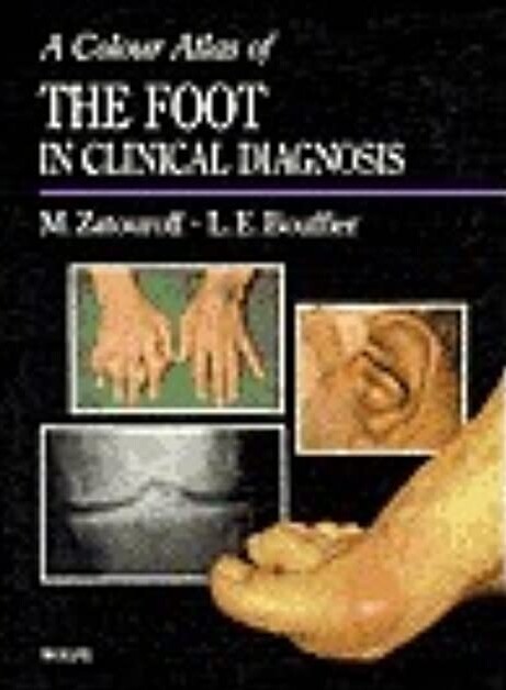Color Atlas of Foot Conditions