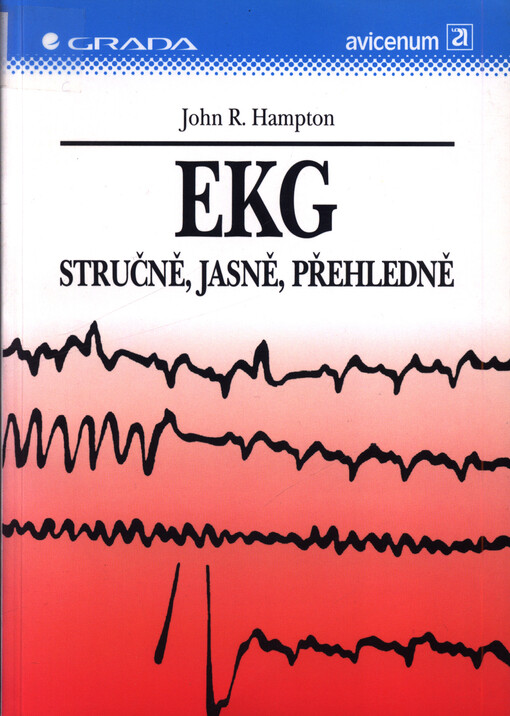 EKG stručně, jasně, přehledně