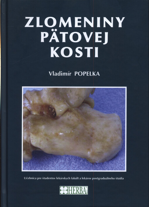 Zlomeniny pätovej kosti