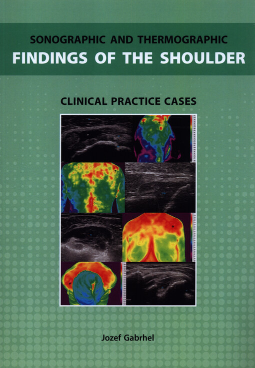 Sonographic and thermographic findings of the shoulder : clinical practice cases