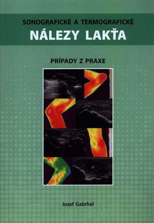 Sonografické a termografické nálezy lakťa : prípady z praxe