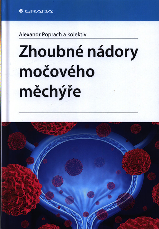 Zhoubné nádory močového měchýře